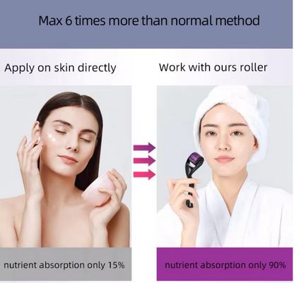 540 Micro Needle Derma Roller