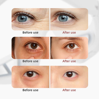 Eye Beauty Device Eye Massager Eye Bag Removal Anti Dark Circle Home Use Beauty Devices