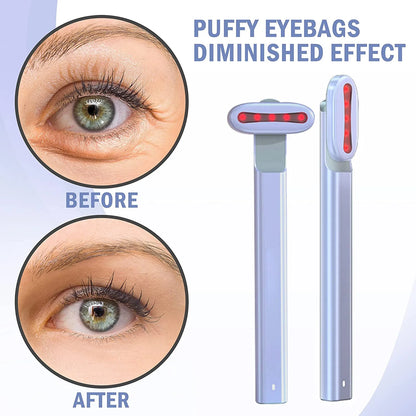 Portable Eye Massage Wand | Heated Eye Massager for Puffiness & Dark Circles – Luxurella