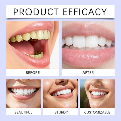 Purple Teeth Whitening Strips | Daily Oral Care Brightening Strips – Luxurella