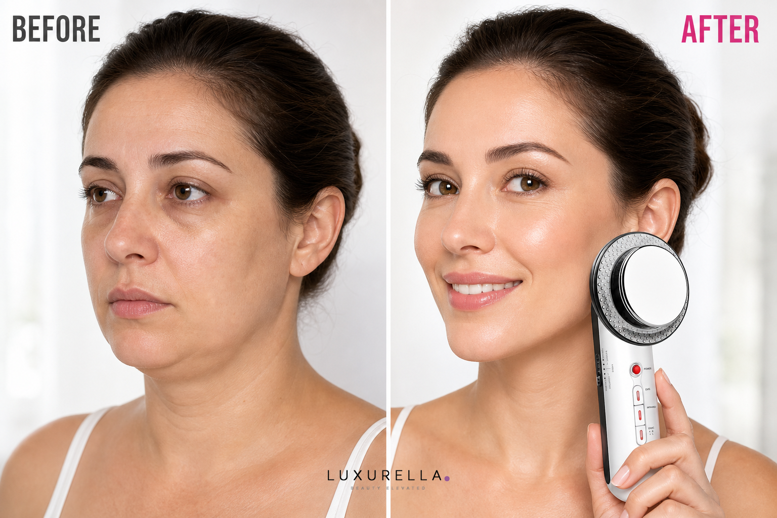 Luxurella 3-in-1 EMS Ultrasound Device - before and after