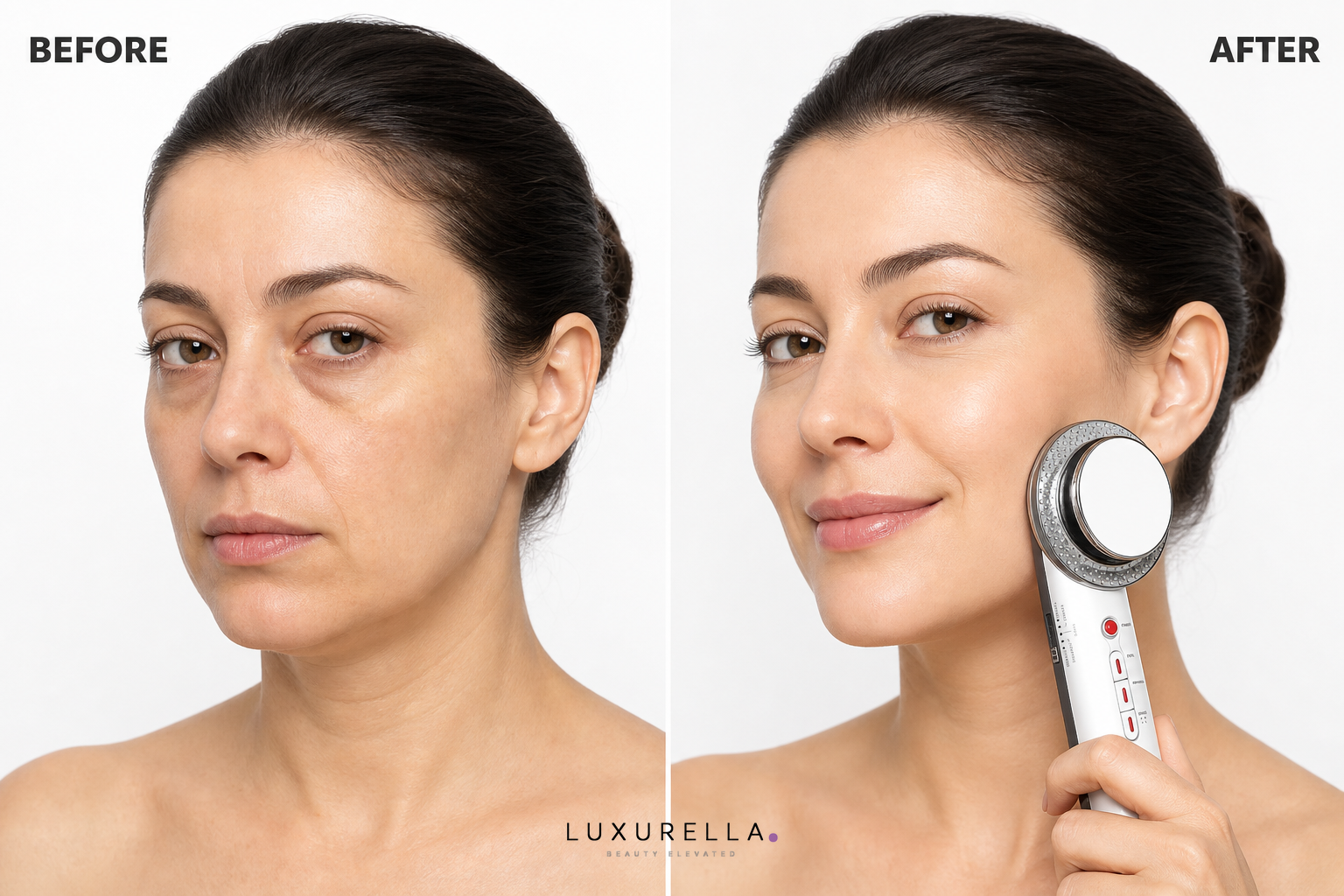 Luxurella 3-in-1 EMS Ultrasound Device - before and after