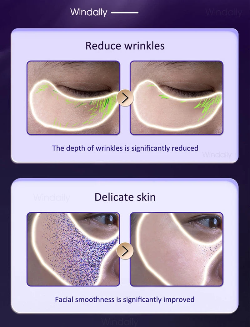 Facial Wand detail 8
