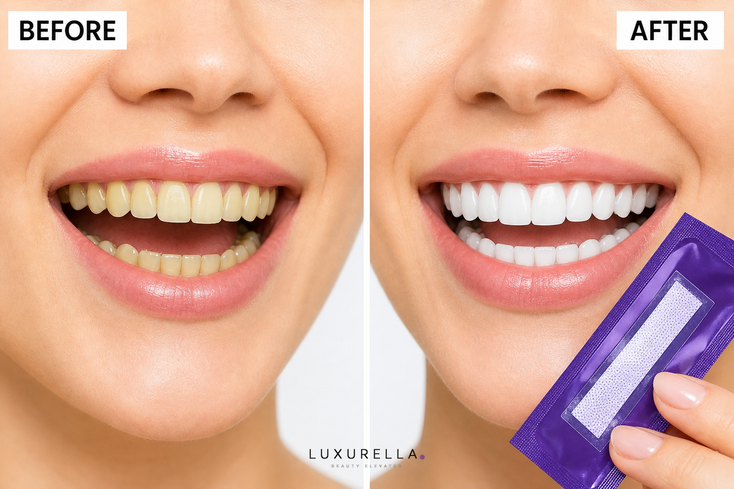 Luxurella Purple Teeth Whitening Strips - before and after